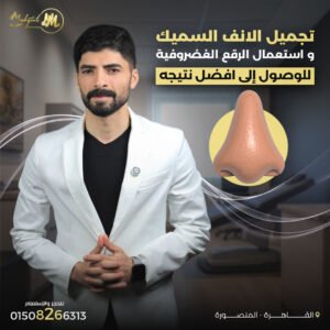 تجميل الأنف السميك