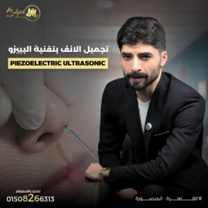 تقنية البييزو