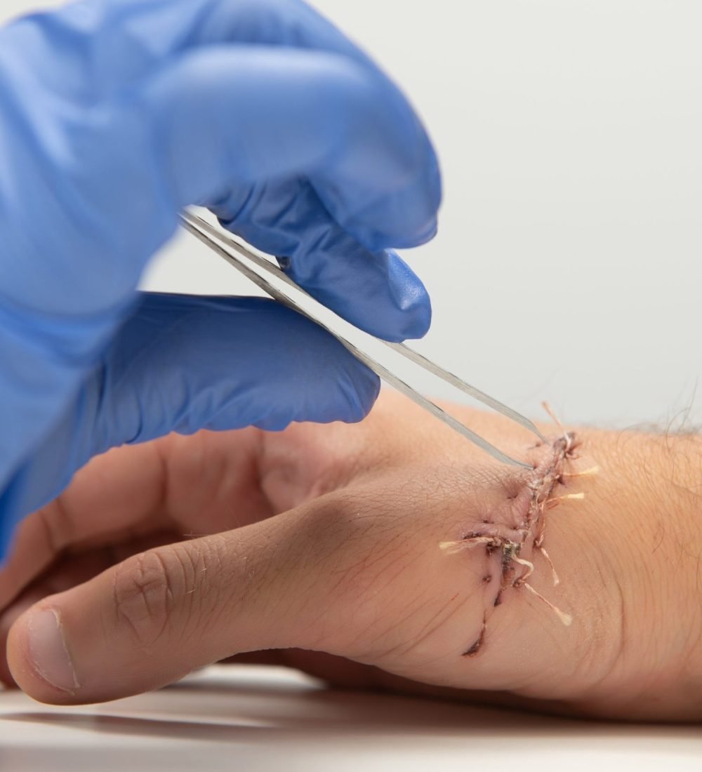 examination by a doctor of a cut on the arm