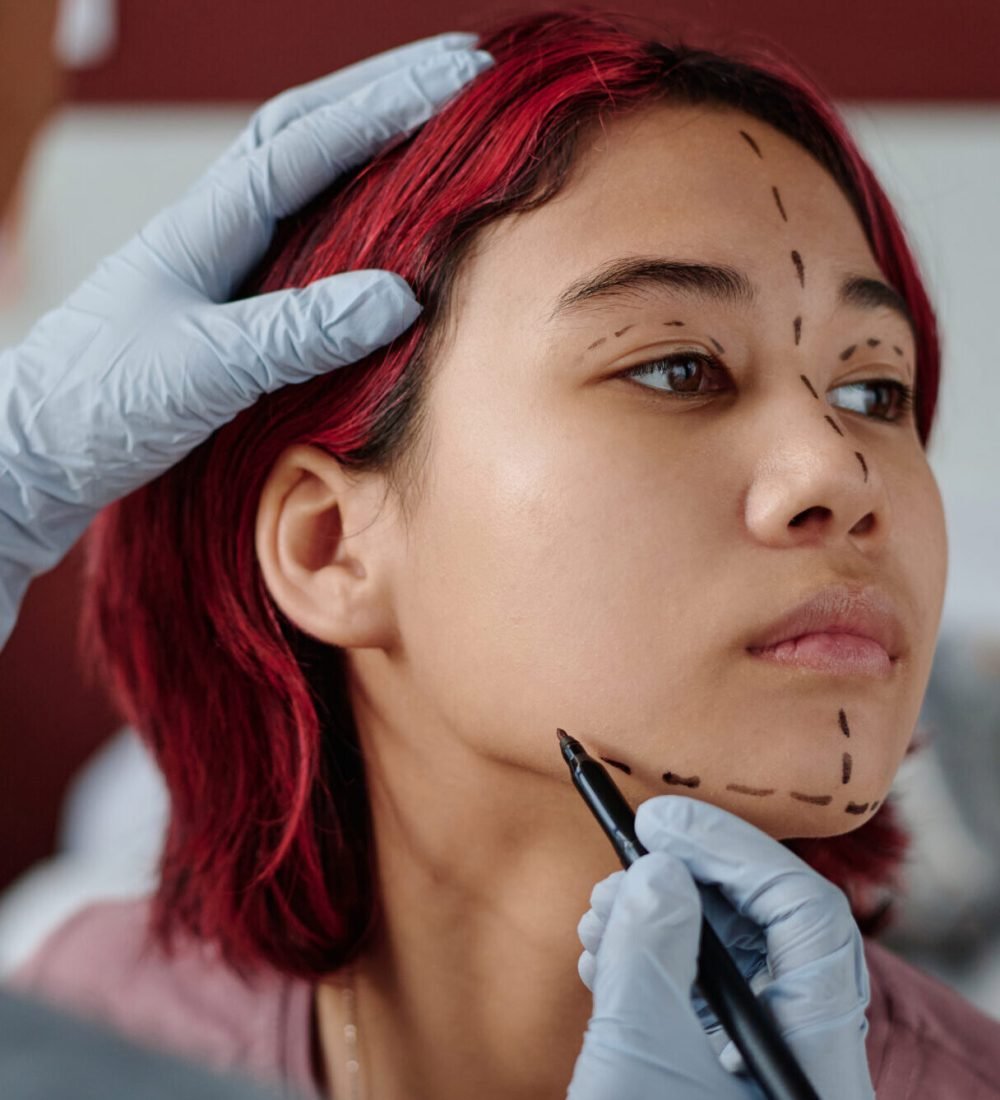 Gloved hands of young professional plastic surgeon with highlighter drawing liftmarks on face of cute teenage girl in clinics